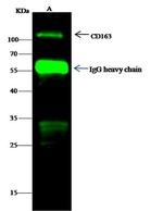 CD163 Antibody in Immunoprecipitation (IP)