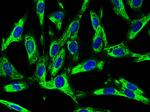 CD106 (VCAM-1) Antibody in Immunocytochemistry (ICC/IF)