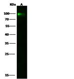 CD106 (VCAM-1) Antibody in Western Blot (WB)