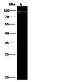 ABCB5 Polyclonal Antibody
