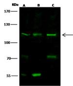 Desmoglein 1 Polyclonal Antibody