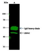 PREX1 Antibody in Immunoprecipitation (IP)