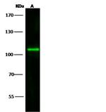 TLR8 Antibody in Western Blot (WB)