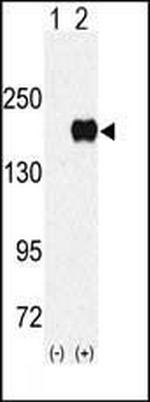 EHMT1 Polyclonal Antibody