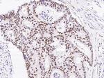 TCF12 Antibody in Immunohistochemistry (Paraffin) (IHC (P))