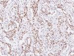 TCF12 Antibody in Immunohistochemistry (Paraffin) (IHC (P))