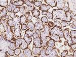 GH2 Antibody in Immunohistochemistry (Paraffin) (IHC (P))
