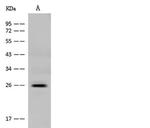 GH2 Antibody in Western Blot (WB)