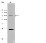 ALDH9A1 Polyclonal Antibody