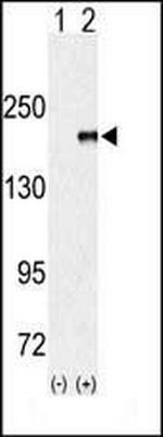 EHMT1 Polyclonal Antibody