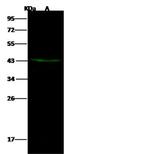 DACH2 Polyclonal Antibody