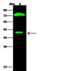 CTBS Polyclonal Antibody