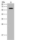 ARIH1 Antibody in Western Blot (WB)