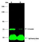 CTAGE1 Antibody in Immunoprecipitation (IP)