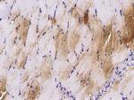 HSPB7 Antibody in Immunohistochemistry (Paraffin) (IHC (P))
