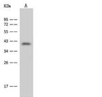 FBXO28 Antibody in Western Blot (WB)