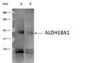 ALDH18A1 Antibody in Immunoprecipitation (IP)