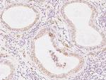 COX17 Polyclonal Antibody