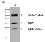 Nurim Antibody in Immunoprecipitation (IP)