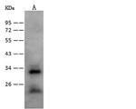 Nurim Antibody in Western Blot (WB)