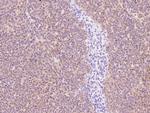 P2Y6 Polyclonal Antibody