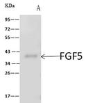VTA1 Antibody in Immunoprecipitation (IP)