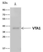 VTA1 Antibody in Immunoprecipitation (IP)