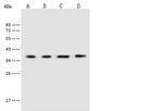 VTA1 Antibody in Western Blot (WB)