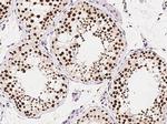 RbAp48 Antibody in Immunohistochemistry (Paraffin) (IHC (P))
