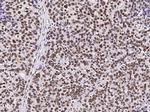 RbAp48 Antibody in Immunohistochemistry (Paraffin) (IHC (P))
