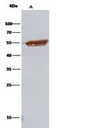 RbAp48 Antibody in Immunoprecipitation (IP)