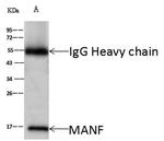 ARMET Antibody in Immunoprecipitation (IP)