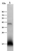 ARMET Polyclonal Antibody
