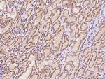 BNIP3L Antibody in Immunohistochemistry (Paraffin) (IHC (P))
