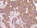 BNIP3L Polyclonal Antibody