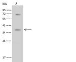 BNIP3L Antibody in Western Blot (WB)