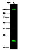 UBE2H Polyclonal Antibody