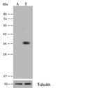 NUDT5 Polyclonal Antibody