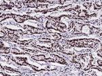 RPRD1B Antibody in Immunohistochemistry (Paraffin) (IHC (P))