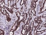 RPRD1B Antibody in Immunohistochemistry (Paraffin) (IHC (P))