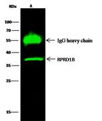 RPRD1B Antibody in Immunoprecipitation (IP)