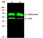 CAPG Antibody in Immunoprecipitation (IP)