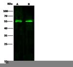WARS Antibody in Western Blot (WB)
