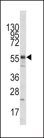 TIP60 Polyclonal Antibody