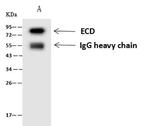 Prolactin Receptor (ECD) Antibody in Immunoprecipitation (IP)