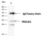 PRELID1 Antibody in Immunoprecipitation (IP)