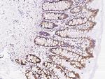 MUT Antibody in Immunohistochemistry (Paraffin) (IHC (P))