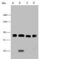 MUT Antibody in Western Blot (WB)