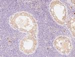 EB1 Antibody in Immunohistochemistry (Paraffin) (IHC (P))