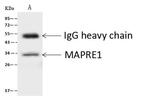 EB1 Antibody in Immunoprecipitation (IP)